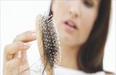 Mai hoa châm điều trị rụng tóc